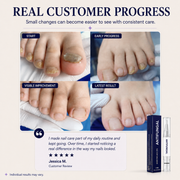 Elarumi™ Antifungal Pen