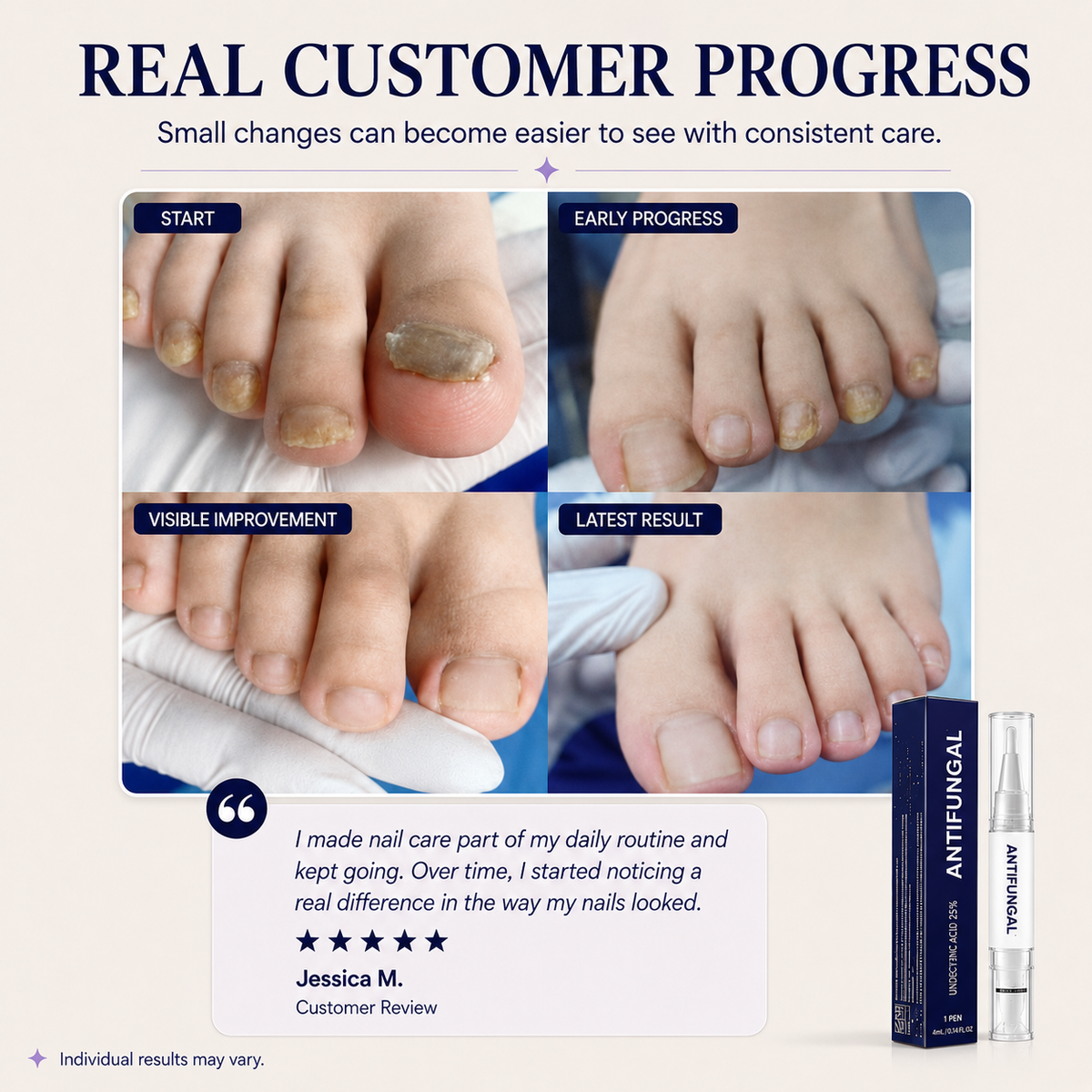 Elarumi™ Antifungal Pen