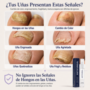 Elarumi™ Pluma Antimicótica para Uñas