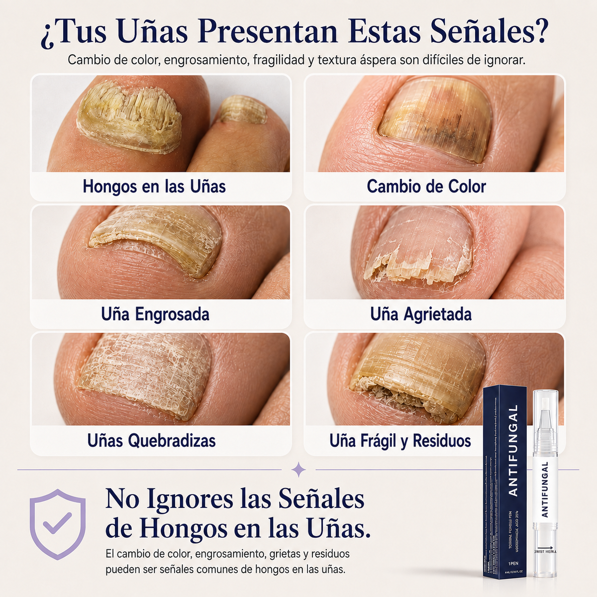 Elarumi™ Pluma Antimicótica para Uñas