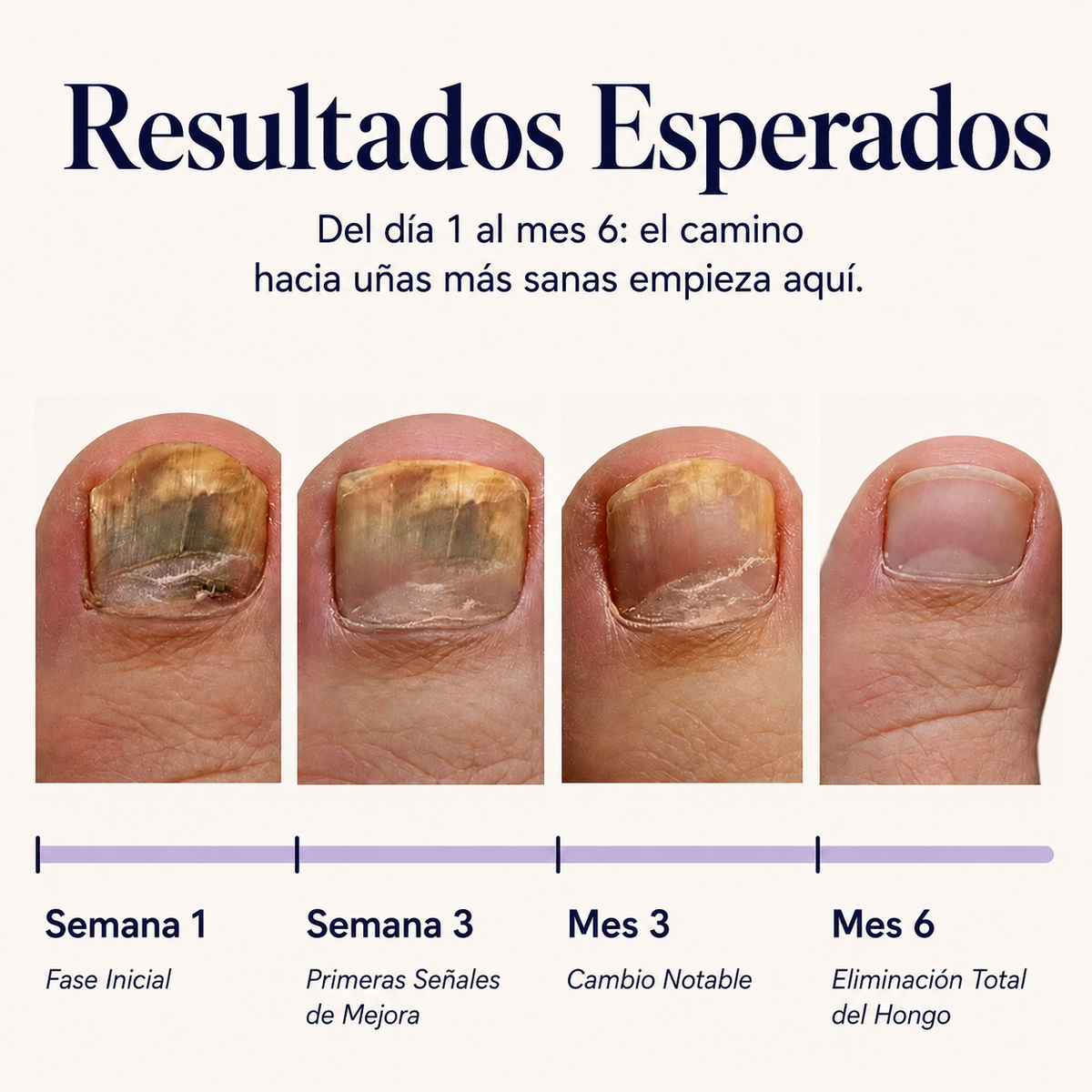 Start Now. So You Don’t Have to Hide Your Feet Later.