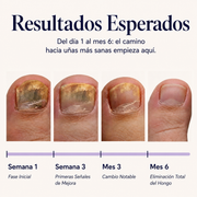 Elarumi™ Pluma Antimicótica para Uñas