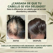 Champú Herbal – Estimula El Crecimiento Del Cabello Y Ayuda A Fortalecerlo