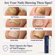 Elarumi™ Antifungal Pen