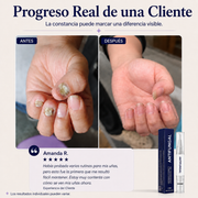 Elarumi™ Pluma Antimicótica para Uñas